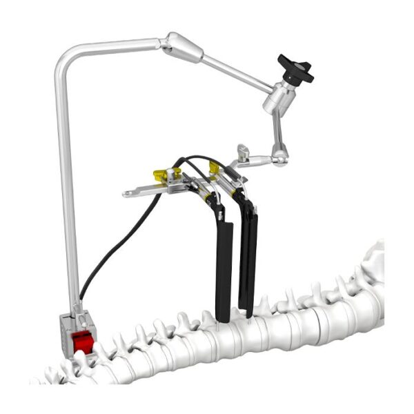 Juego de instrumentos para el sistema de acceso anterolateral a la columna vertebral MIS