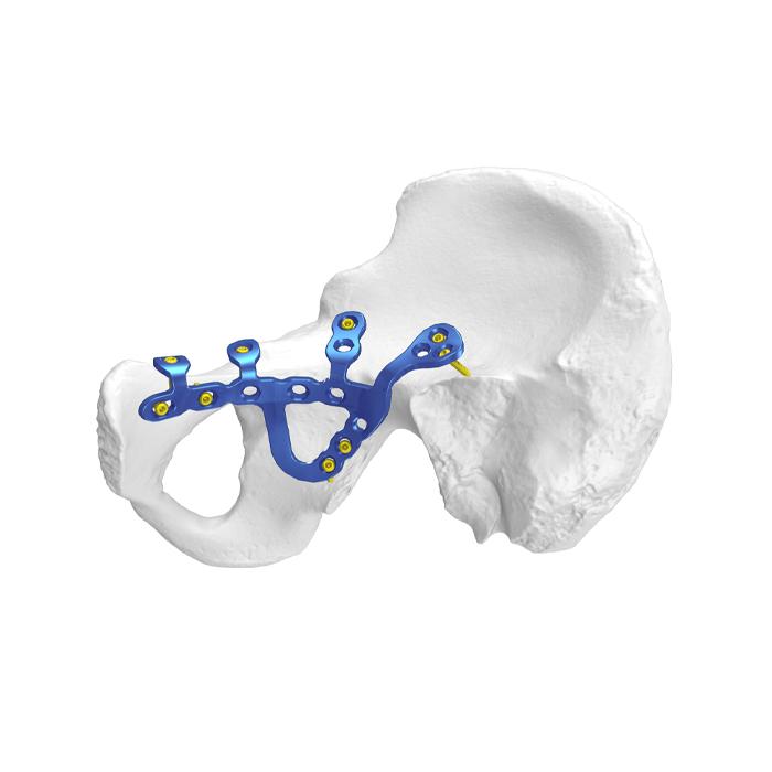 Placa de bloqueo acetabular pélvica anatómica