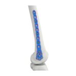 Placa de bloqueo femoral distal