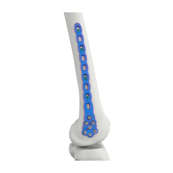 Placa de bloqueo femoral distal