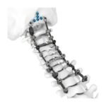 Sistema de Columna Cervical Posterior HOBBIT 3,5/4,0