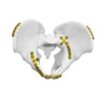 Placa cuadrangular de la superficie posterior