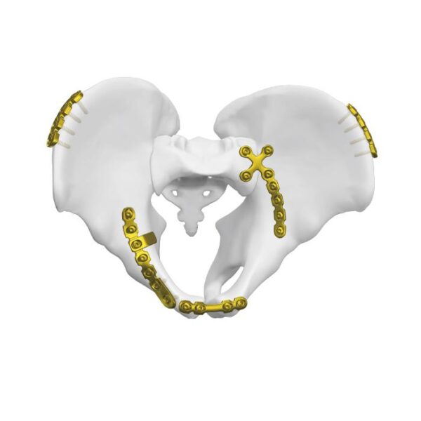 Placa cuadrangular de la superficie posterior