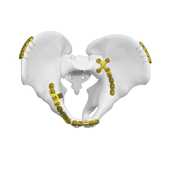 Placa cuadrangular de la superficie posterior